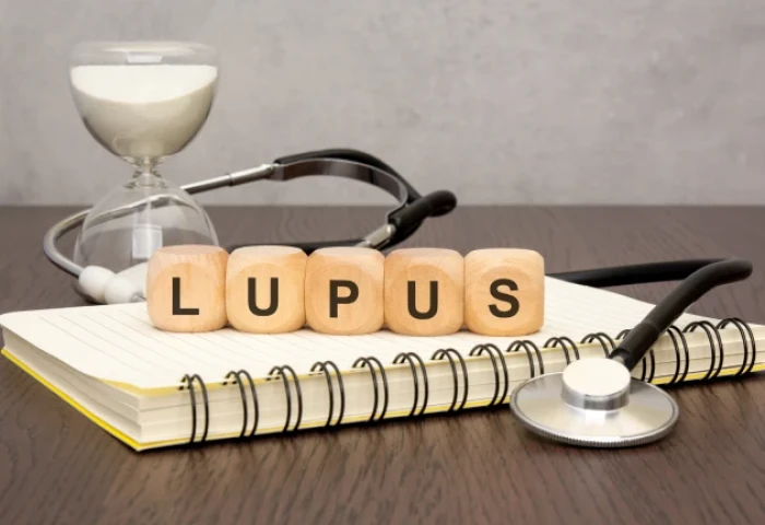 Tratamento de lúpus com RITUXIMABE (MABTHERA®): Plano de saúde deve cobrir? 